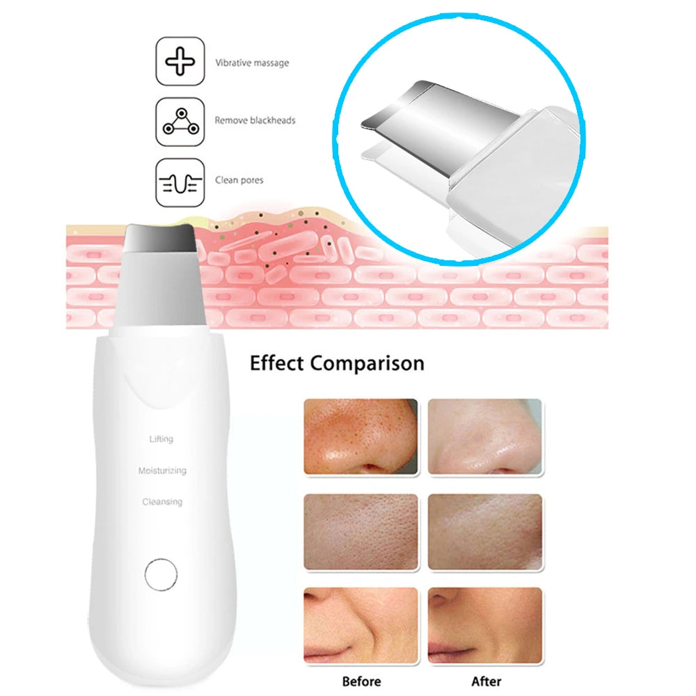 Ultrasonic face scrubber